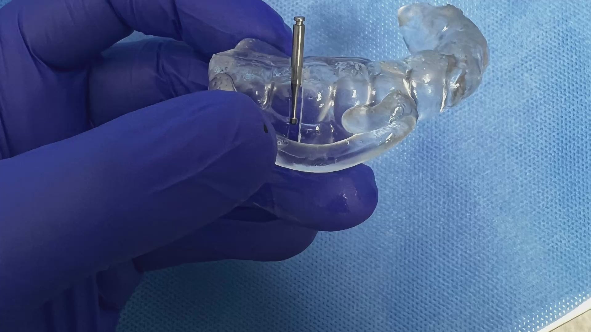 HemiGUIDE endodontic surgical guide showing precise lower molar hemisection with real surgery footage and post operative x ray results