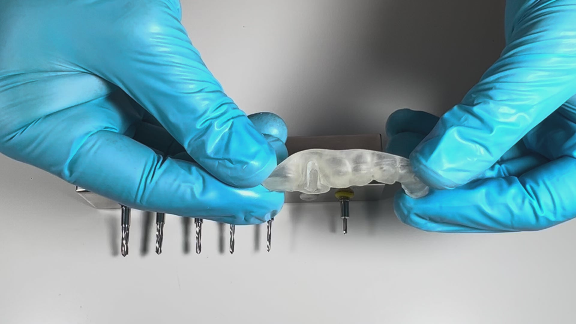AccuraGUIDE dental implant surgical guide during guided implant surgery with precise drill positioning and post operative x ray results